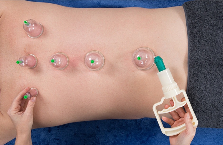 Taller "Aplicación de Ventosas dirigido a Masajistas "